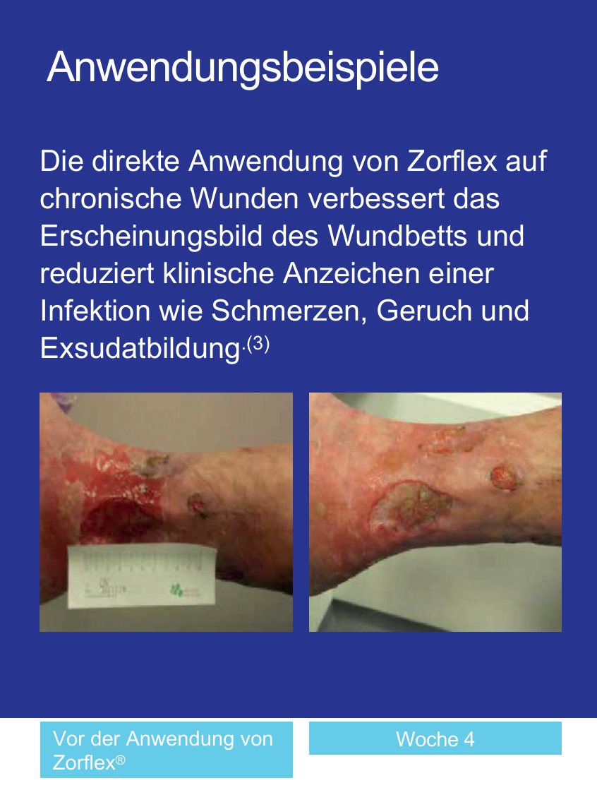 zorflex_2